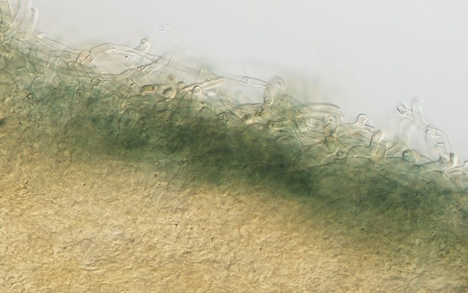 A cross section of pileus surface of Pseudobaeospora taluna, highly magnified showing green reaction in an alkaline solution (Image: Royal Botanic Gardens Victoria)